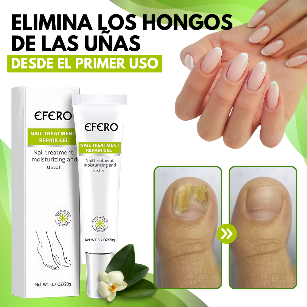 MYCARE™  ELIMINA LOS HONGOS DE LAS UÑAS EN 5 DÍAS Y EVITA QUE APEREZCAN PARA SIEMPRE