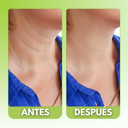 NECKPON® | EL ÚNICO SERUM CON COLAGENO HIDROLIZADO AVALADO POR LA ORGANIZACIÓN MUNDIAL DE LA SALUD QUE ELIMINA LAS ARRUGAS DE TU CARA, CUELLO Y ESCOTE EN 21 DÍAS