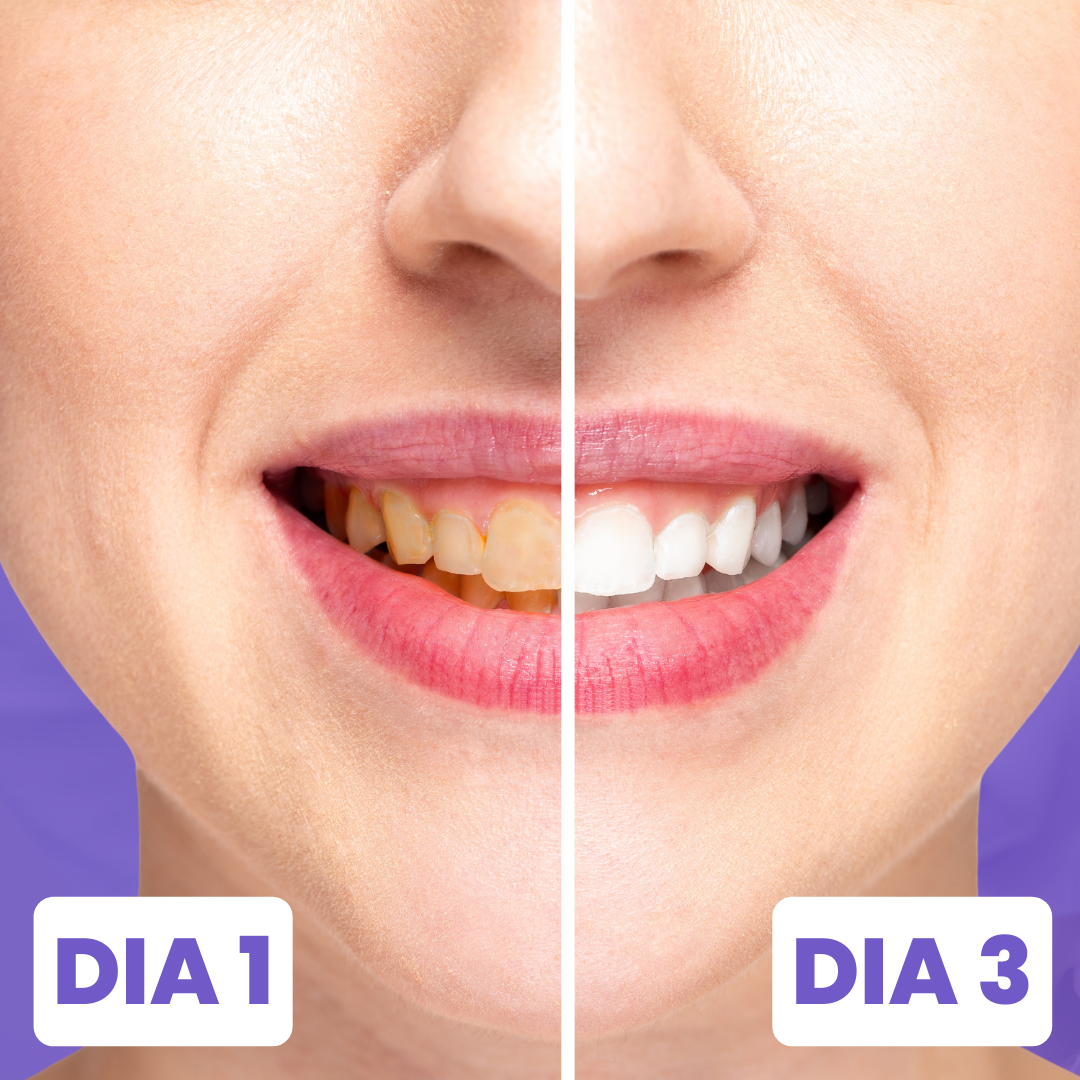 HI SMILE™ BLANQUEA TUS DIENTES Y LUCE UNA SONRISA RADIANTE