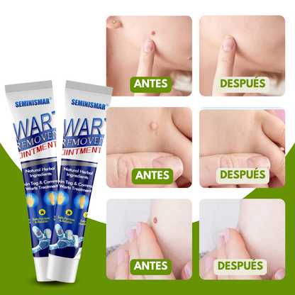 WARTOFF™ - ELIMINA LAS VERRUGAS Y EL ACNÉ EN MENOS DE DOS SEMANAS