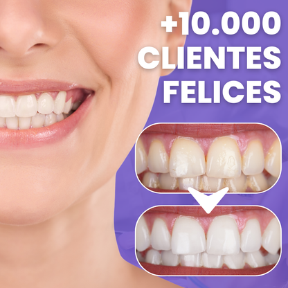 HI SMILE™ BLANQUEA TUS DIENTES Y LUCE UNA SONRISA RADIANTE