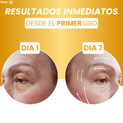 LOVILDS™ - SERUM ANTIENVEJECIMIENTO CON COLAGENO ACTIVO