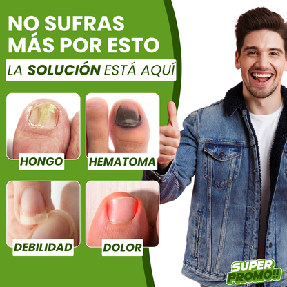 FUNGI NORM™ ELIMINA HONGOS DE RAÍZ: PROTECCIÓN Y ALIVIO PARA TU PIEL Y UÑAS