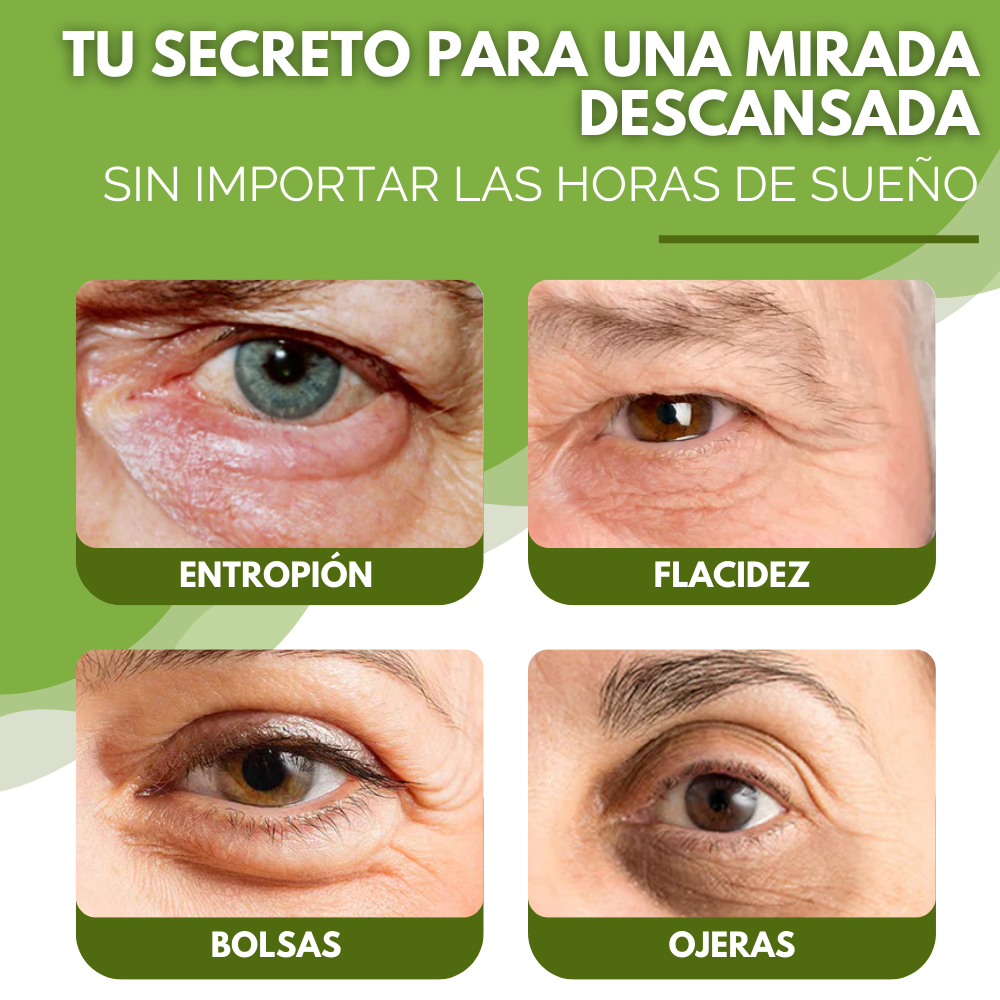 1 + 1 GRATIS | OPENEYES® EL ÚNICO CONTORNO DE OJOS QUE ELIMINA EL 100% DE LAS OJERAS DESDE LA PRIMERA SEMANA