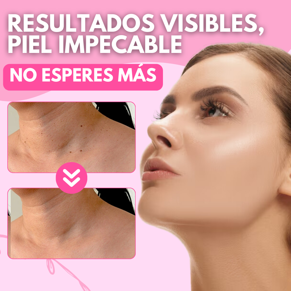 CLEAR SKIN PRO™ NUEVA FORMULA REMOVEDORA DE LUNARES, PECAS Y VERRUGAS